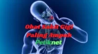 Obat Sakit Gigi Paling Ampuh, Sudah Terbukti Khasiatnya