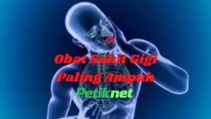 Obat Sakit Gigi Paling Ampuh, Sudah Terbukti Khasiatnya