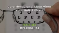 Cara Mengurangi Mata Minus Yang Baik & Efektif