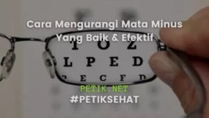 Cara Mengurangi Mata Minus Yang Baik & Efektif