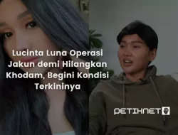 Lucinta Luna Operasi Jakun demi Hilangkan Khodam, Begini Kondisi Terkininya
