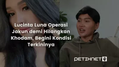 Lucinta Luna Operasi Jakun demi Hilangkan Khodam, Begini Kondisi Terkininya