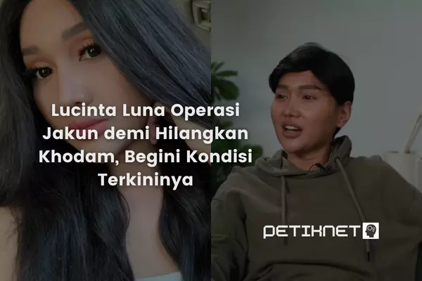 Lucinta Luna Operasi Jakun demi Hilangkan Khodam, Begini Kondisi Terkininya